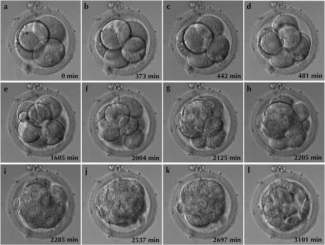 Embryo Definition And Examples Biology Online Dictionary