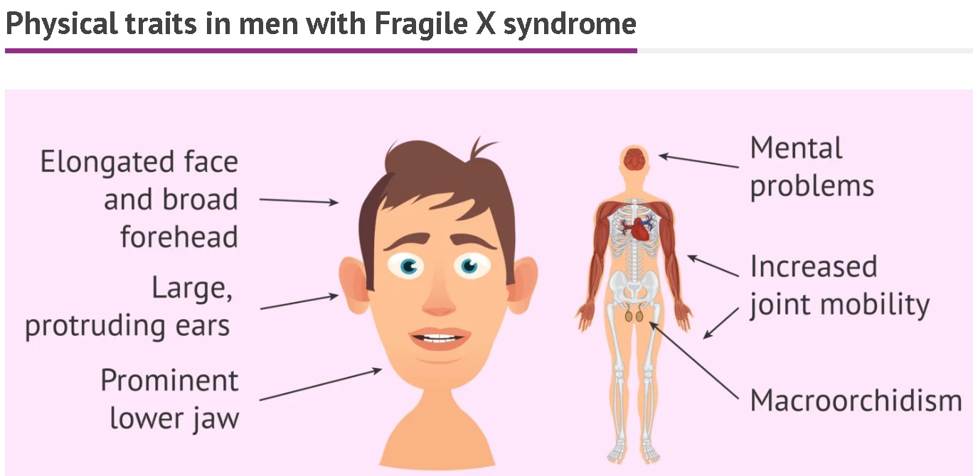 Syndrome Definition and Examples - Biology Online Dictionary