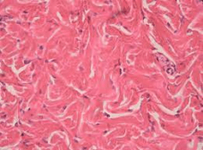 Dense irregular connective tissue - Biology Online Dictionary