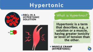 Hypertonic definition example