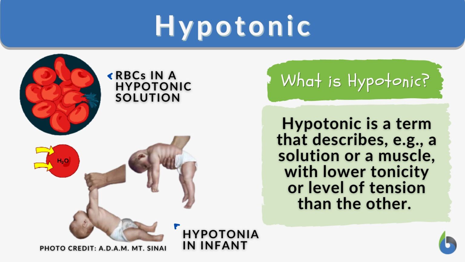 hypotonic-definition-and-examples-biology-online-dictionary