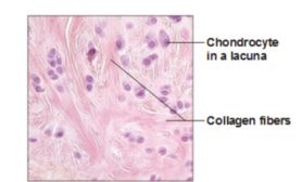 Fibrocartilage - Definition and Examples - Biology Online Dictionary