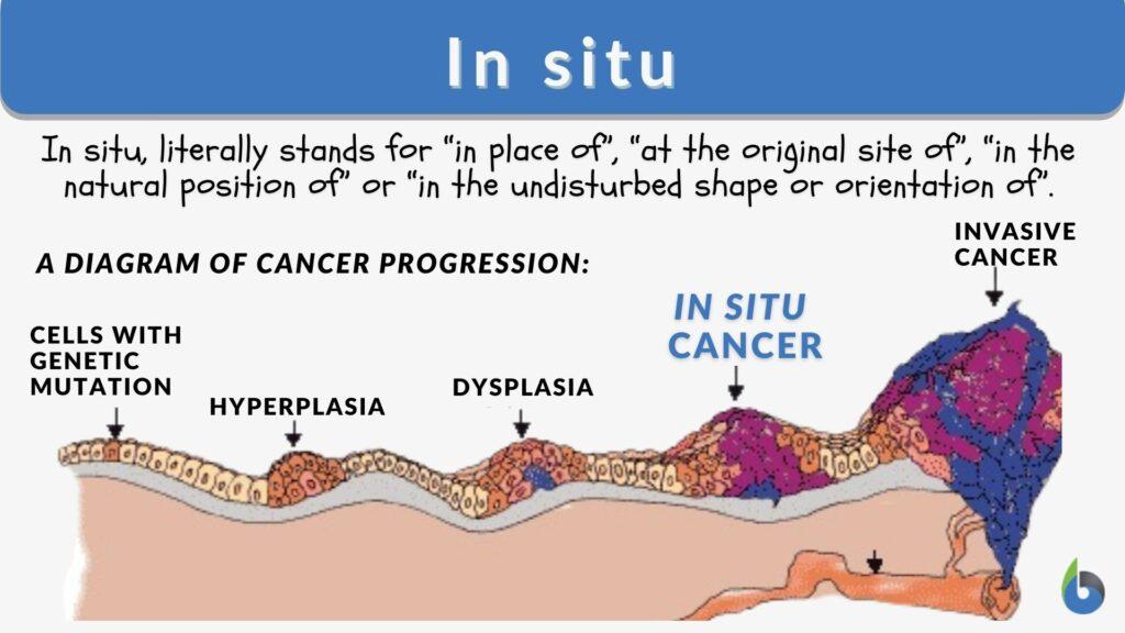 in-situ-definition-and-examples-biology-online-dictionary