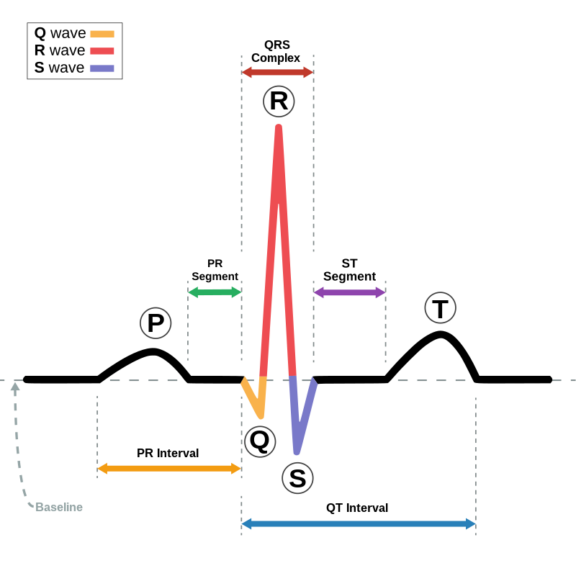 Agonal rhythm - Definition and Examples - Biology Online Dictionary