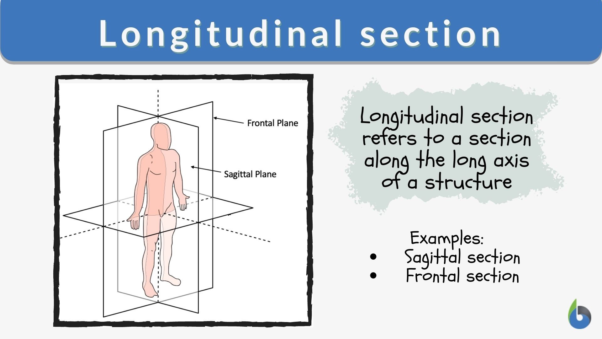 Longitudinal Section Dictionary And Example 