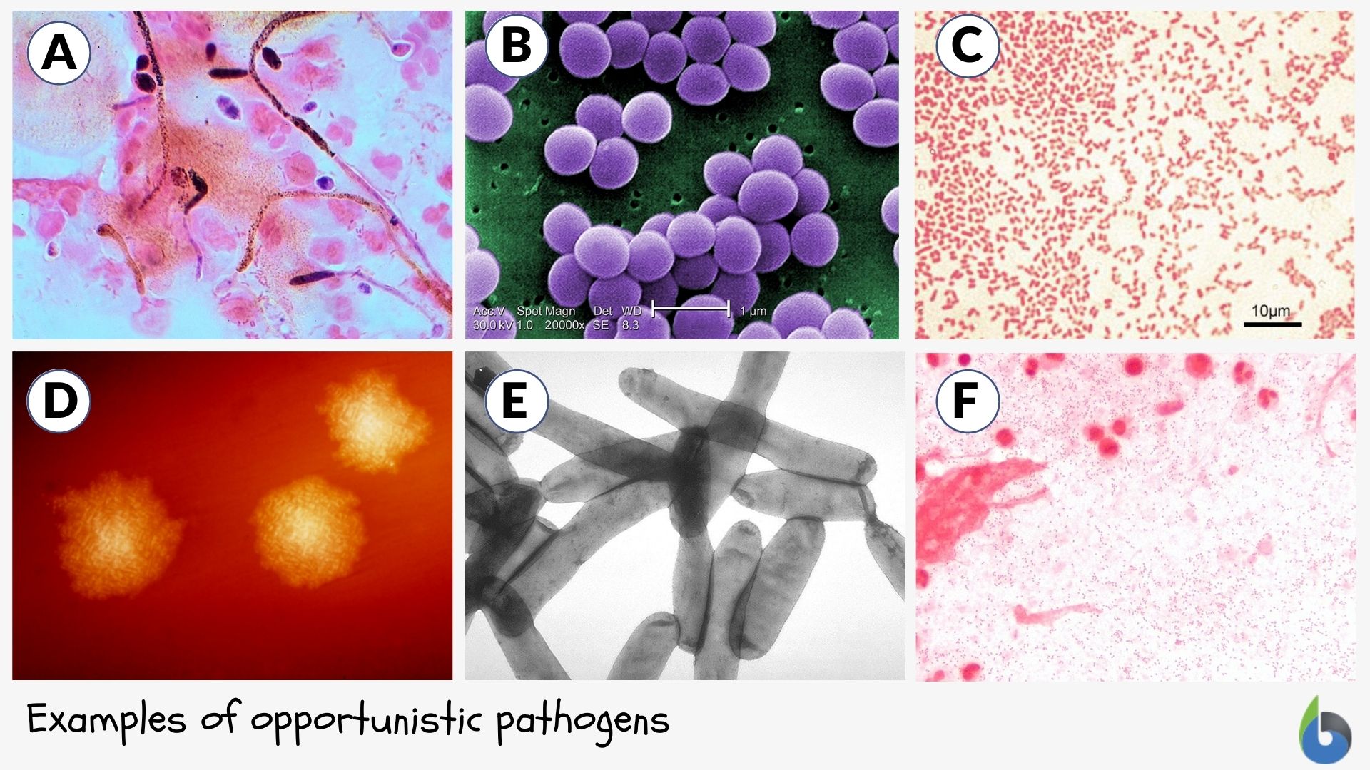 Opportunistic pathogen - Definition and Examples - Biology Online ...