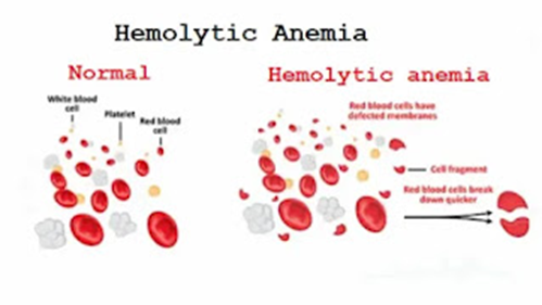 Hemolysis - Definition And Examples - Biology Online Dictionary