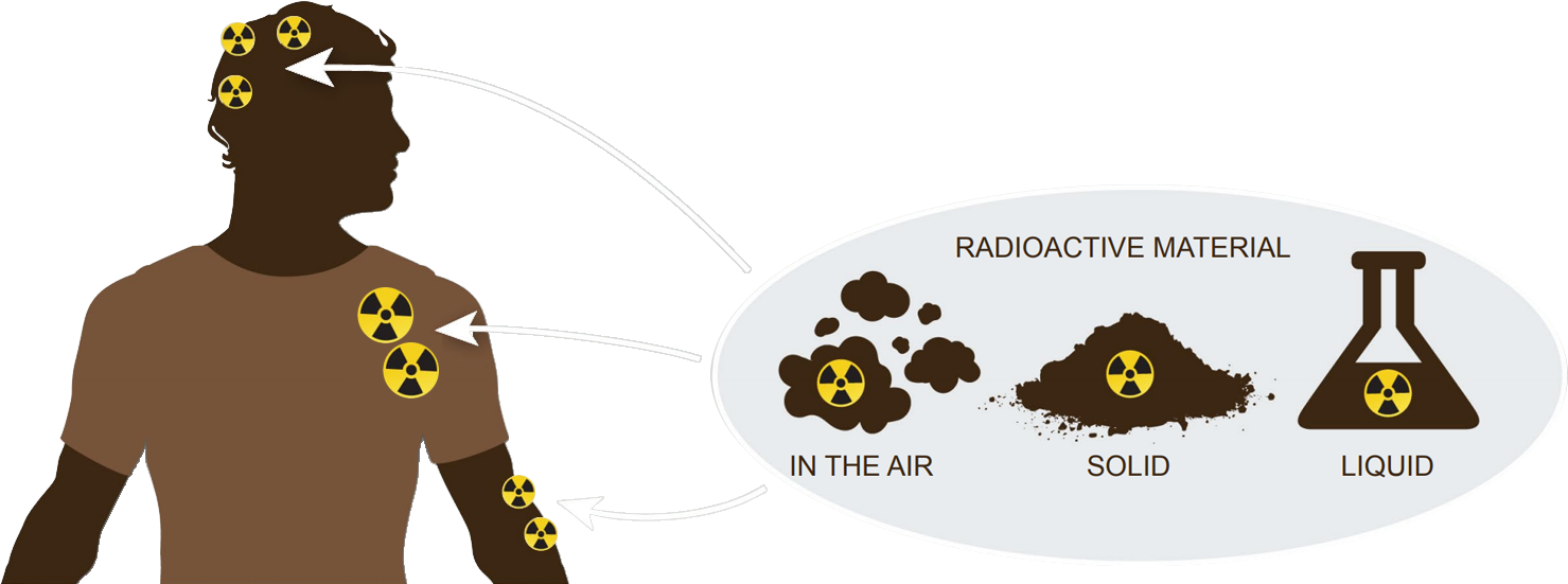 Contamination - Definition And Examples - Biology Online Dictionary