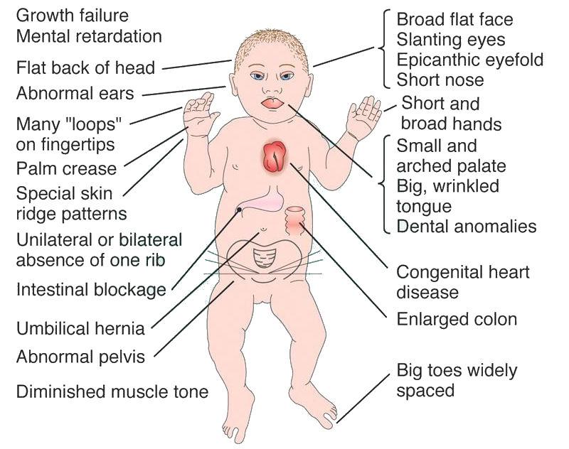 Autosome - Definition and Examples - Biology Online Dictionary